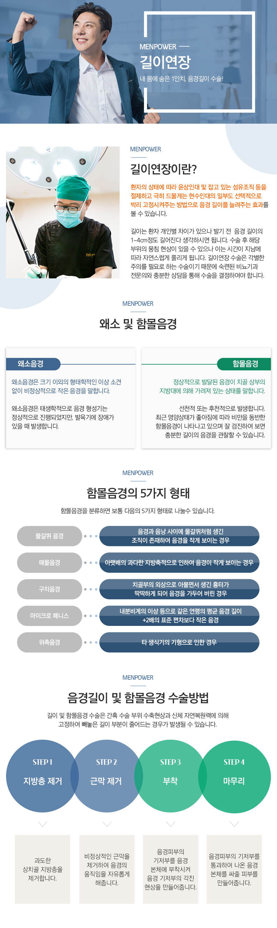 길이연장