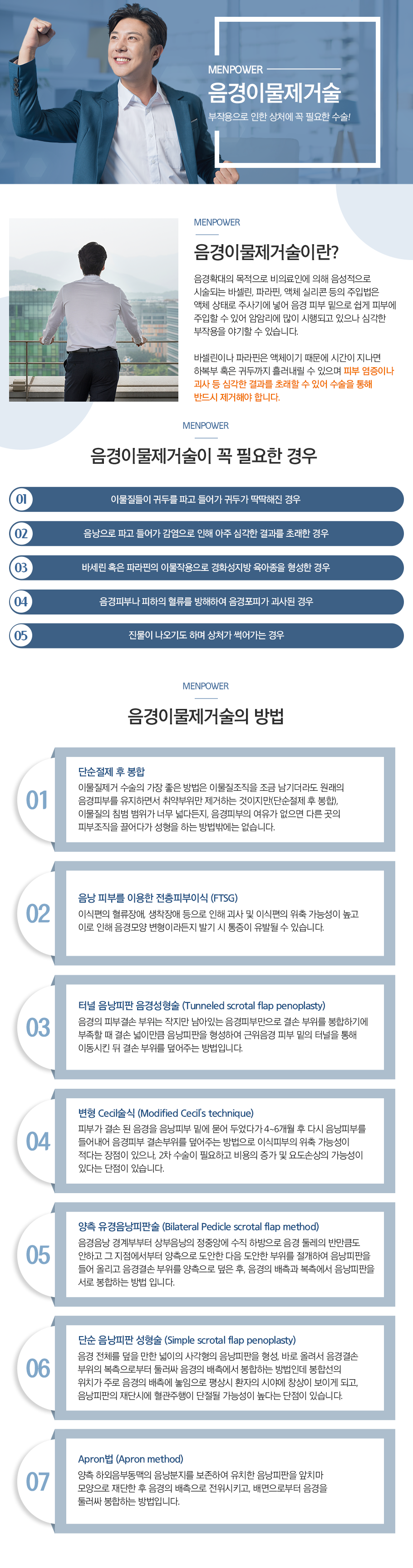 음경이물제거술