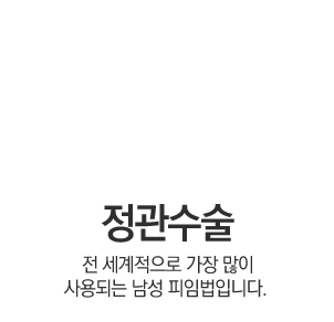 정관수술